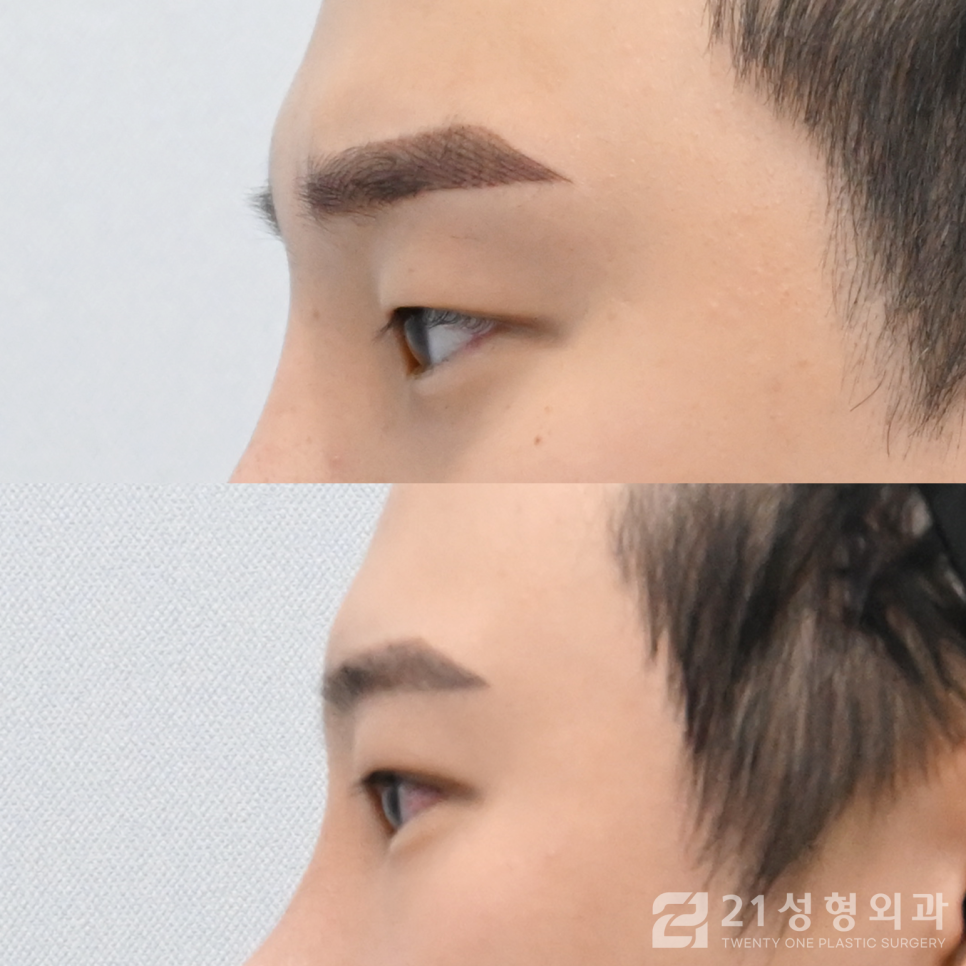 첫눈성형잘하는곳 아름다워지는 지름길 관련 이미지 3