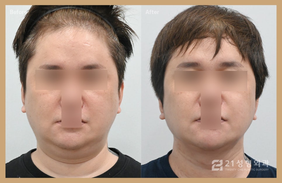 이것만 하면 굳이 살 빼지 않아도 된다. 관련 이미지 1