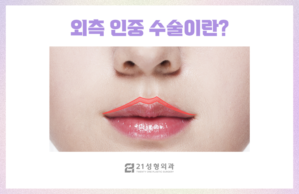 강남인중성형만으로 중안부 줄이기 관련 이미지 7