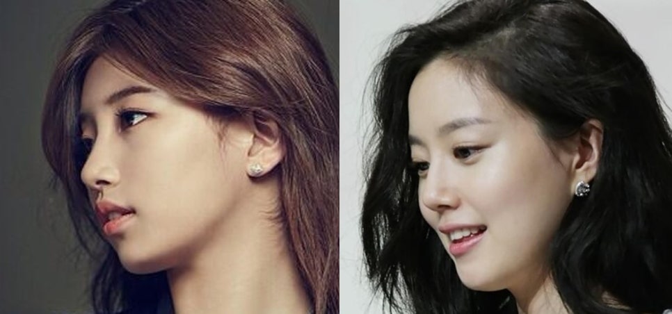 [코 성형] 남자 코 성형은 어떻게? 관련 이미지 6