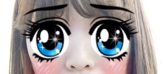 [눈 성형] 앞트임과 몽고주름 관련 이미지 8
