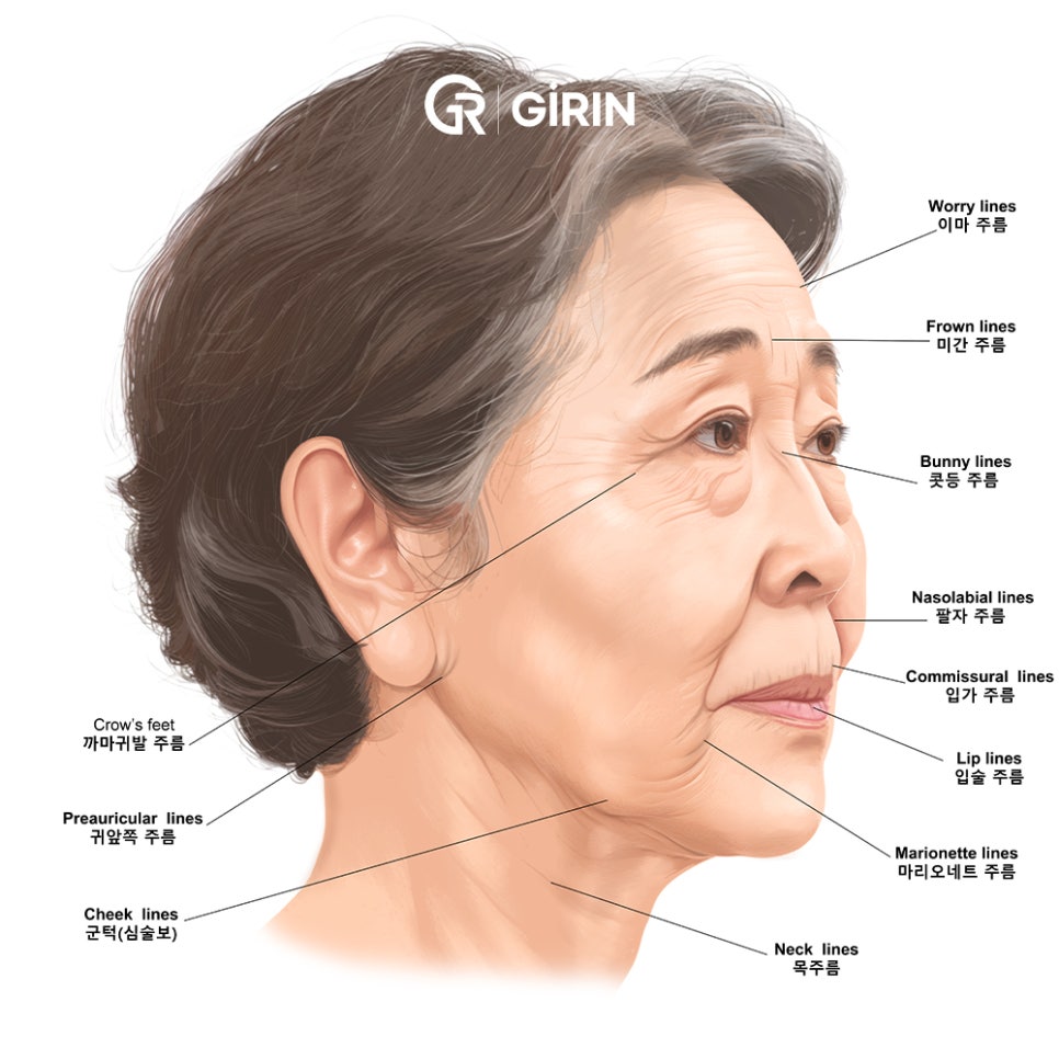 안면거상 비용, 왜 이렇게 차이 날까? 관련 이미지 2
