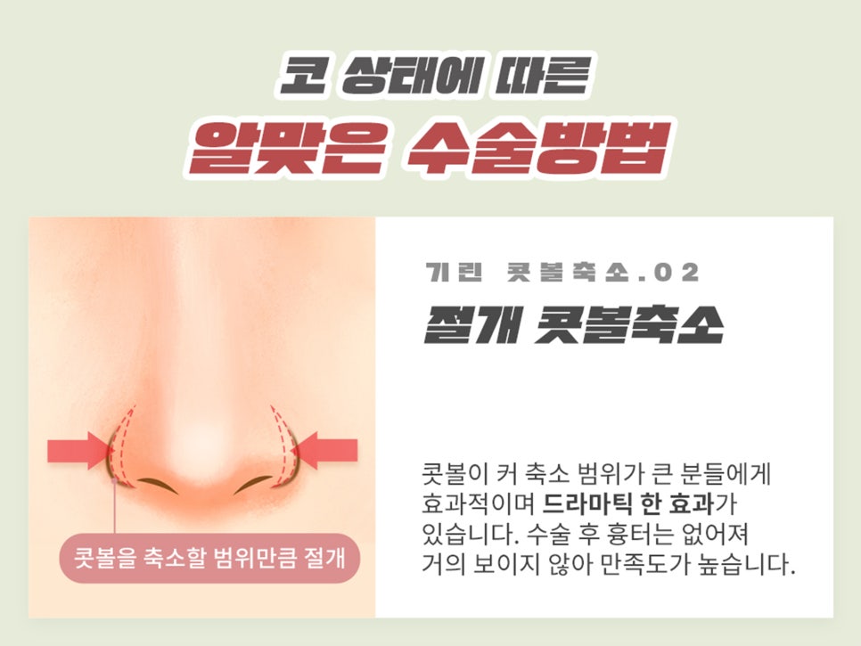 복코수술후기 제대로 찾아야 하는 이유는 관련 이미지 7