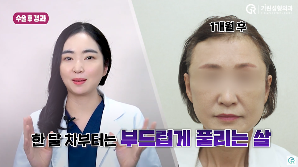 [기린성형외과의원] 부모님들 사이에서 유행하는 성형_안면거상 수술일지 관련 이미지 7