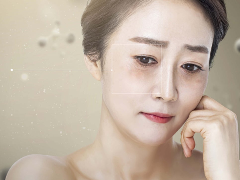 상안검수술잘하는곳 알아본다면 관련 이미지 9