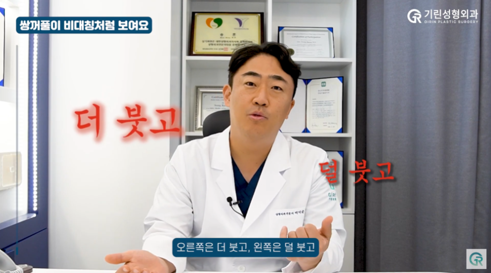 [기린성형외과] 내 눈은 망한걸까 부기일까?_눈성형 Q&A 관련 이미지 3