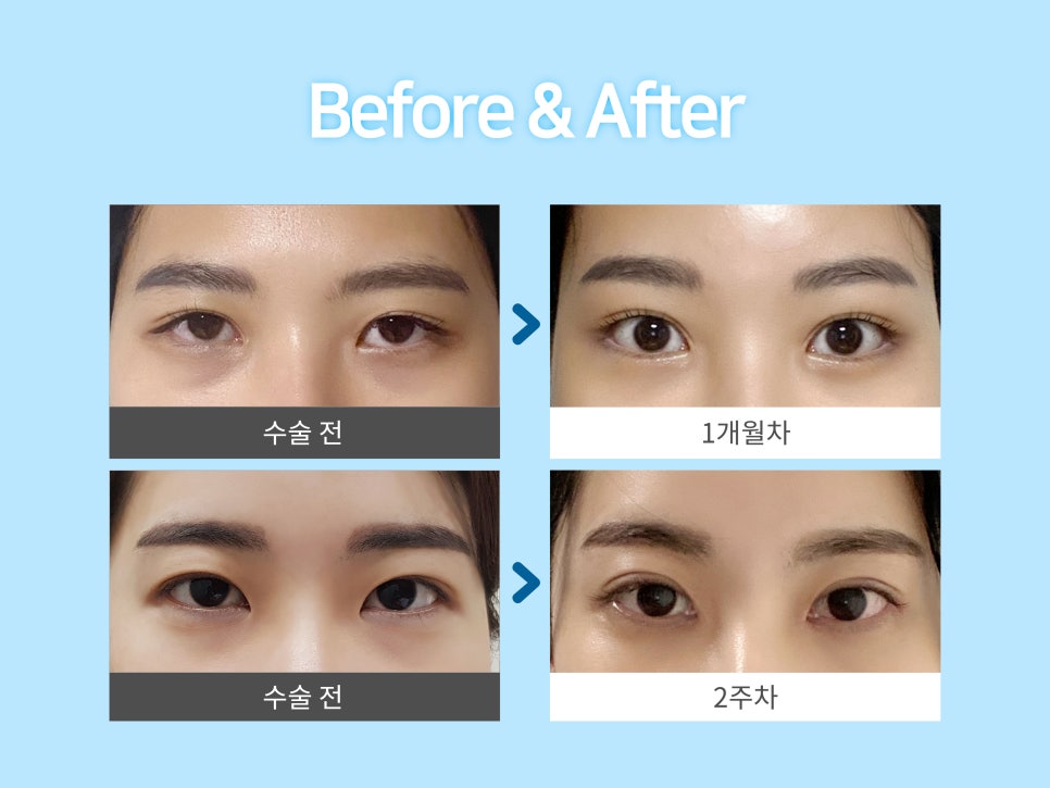 이마거상술 미리 확인해야 할 부분은? 관련 이미지 3