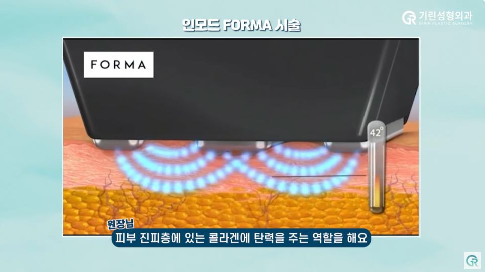 [기린성형외과의원] 수술 없이 턱라인 개선하기_인모드와 지방분해주사 관련 이미지 3