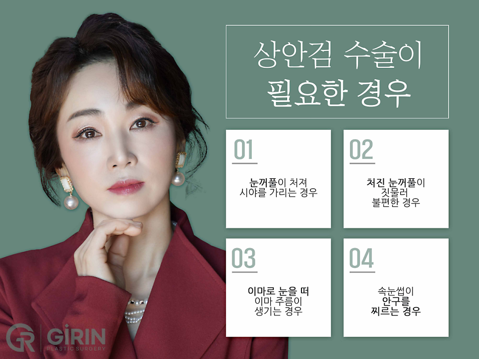 상안검하안검수술 빠른 회복을 위해 관련 이미지 3