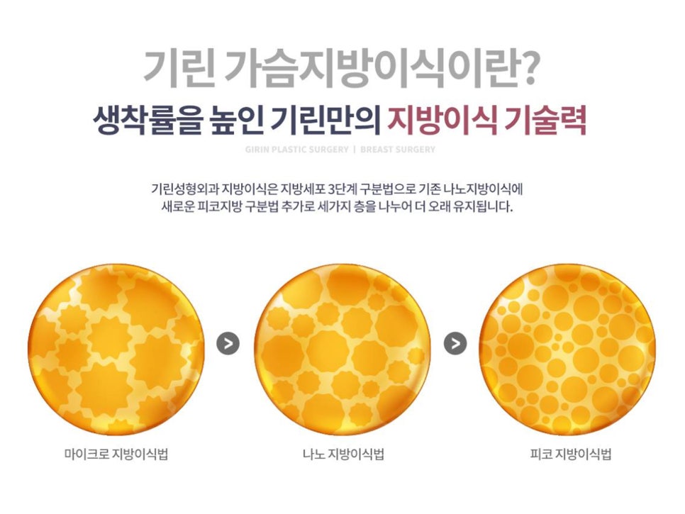 가슴확대수술전후 개선한 모습 궁금하다면 관련 이미지 3