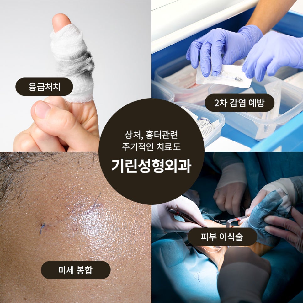 Girin Plastic Surgery for Finger Laceration Suturing, Skin Grafts, and Scar Care image 1
