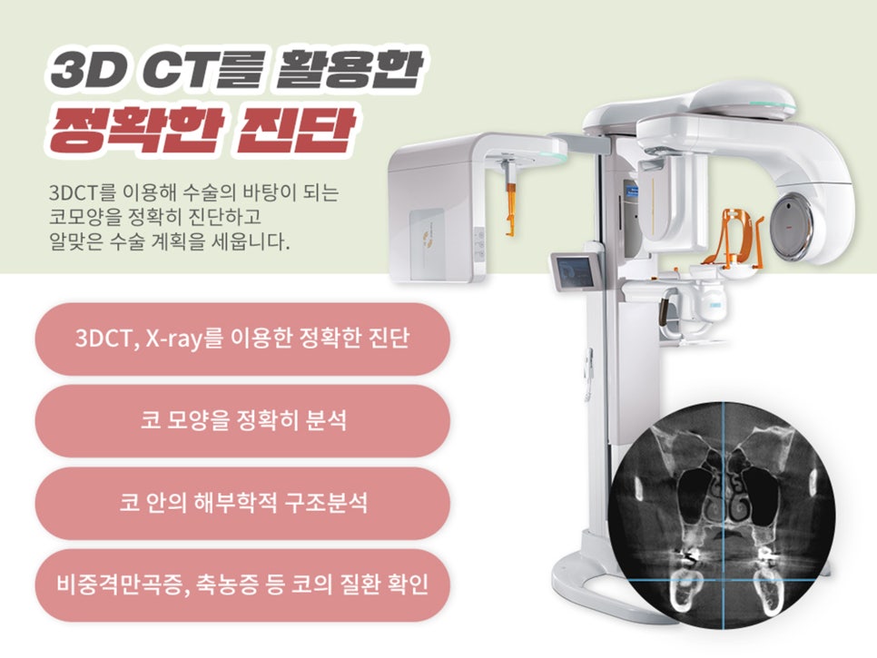 복코수술후기 제대로 찾아야 하는 이유는 관련 이미지 3