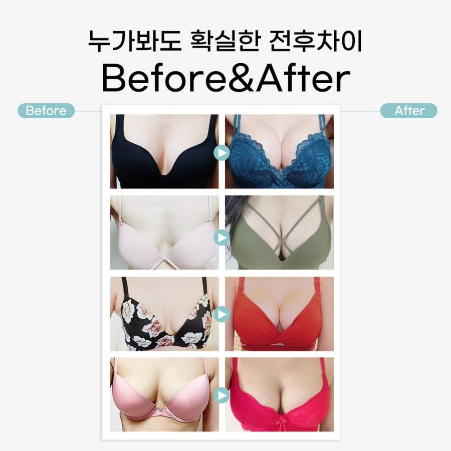 처진가슴성형비용 자신감까지 올려봐 관련 이미지 5