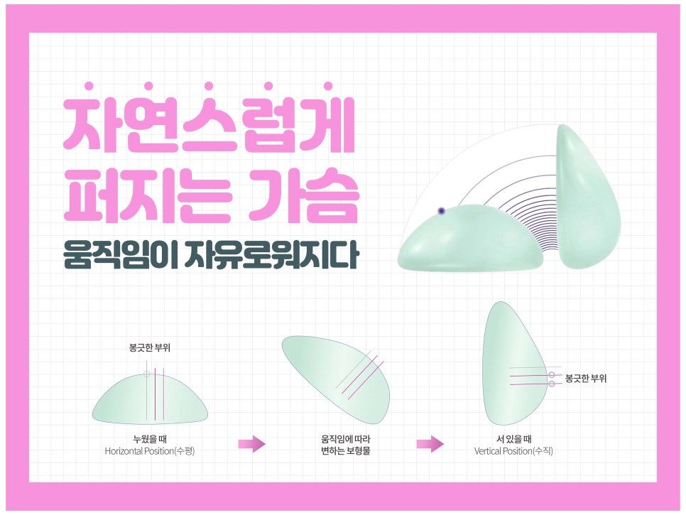 가슴성형전후 비교가 필요하다면 관련 이미지 11