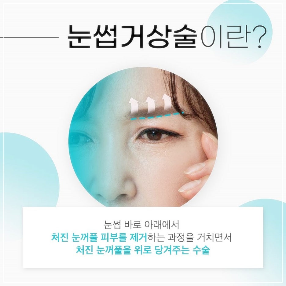 눈썹리프팅 나만알던 동안비결 관련 이미지 2