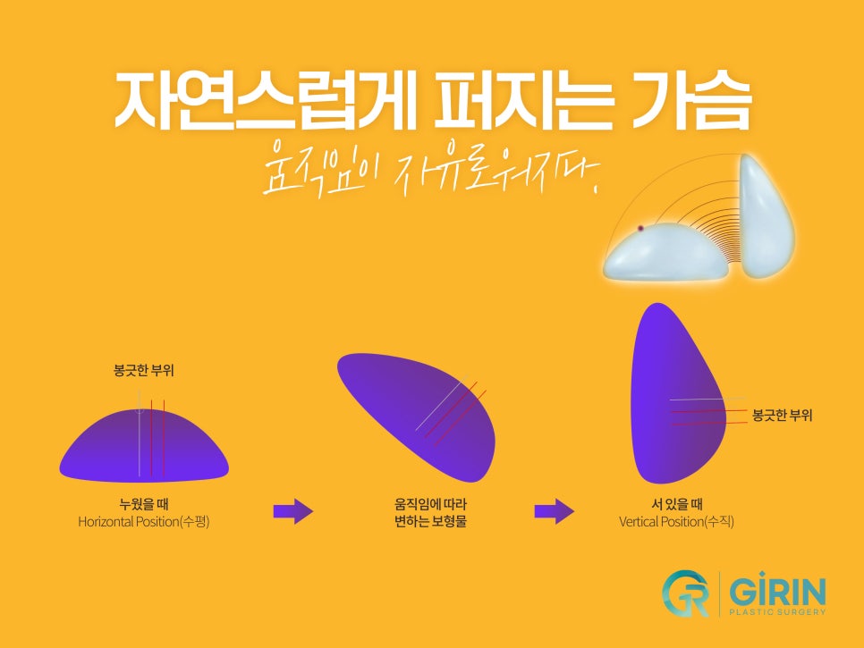 모티바가슴성형후기 세심하게 살펴보며 관련 이미지 5