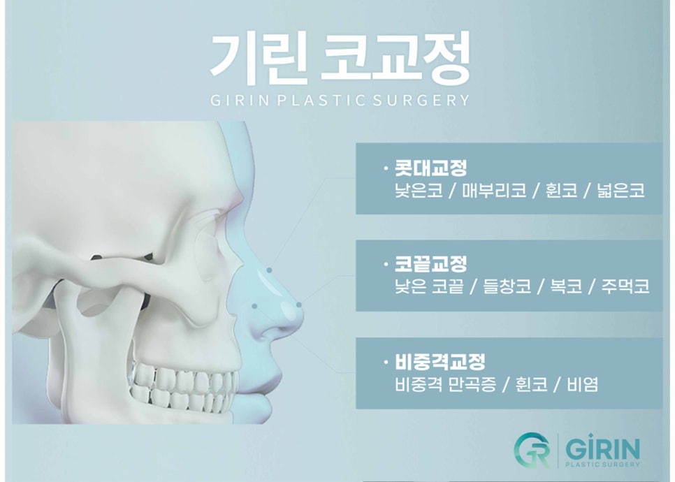 낮은코수술 눈에 보이는 차이를 원한다면 관련 이미지 8