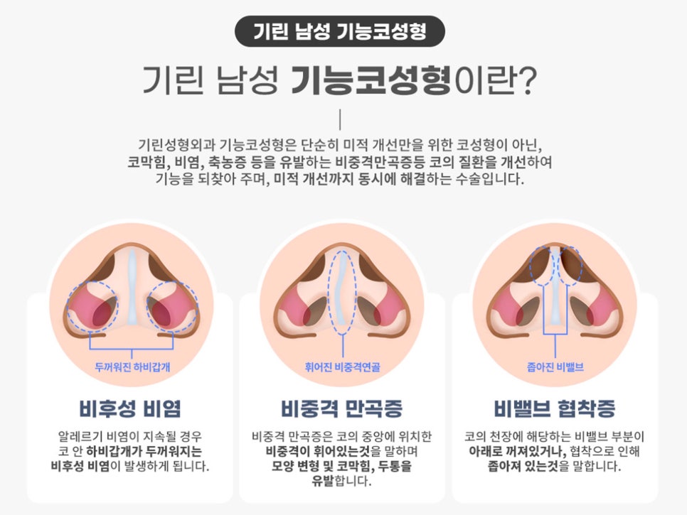 남자코수술전후 주의해서 선택을 관련 이미지 11