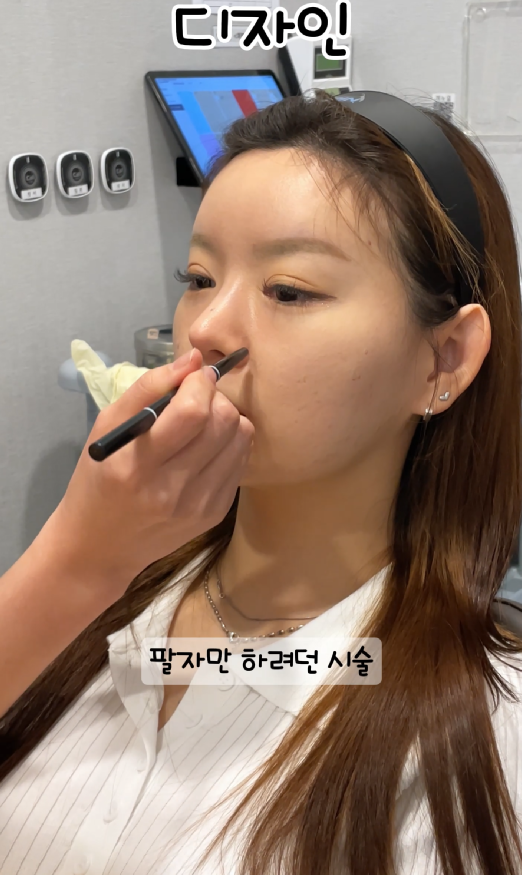 기린성형외과 쥬베룩볼륨 팔자주름, 앞볼, 관자 후기 관련 이미지 5