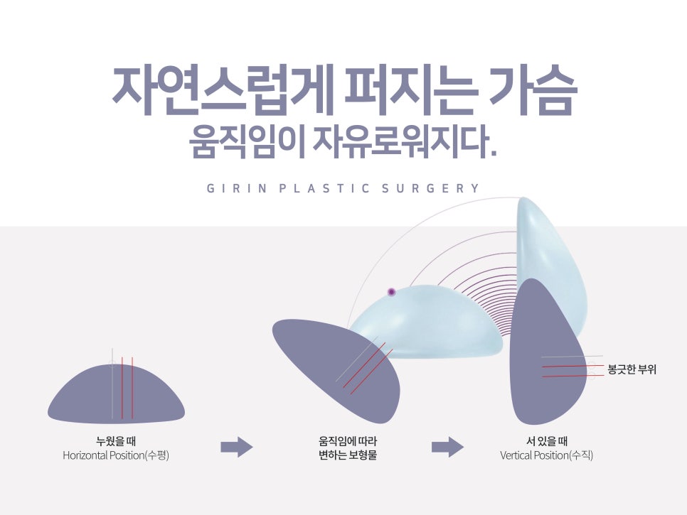 강남가슴성형 달라질 라인 기대하며 관련 이미지 11