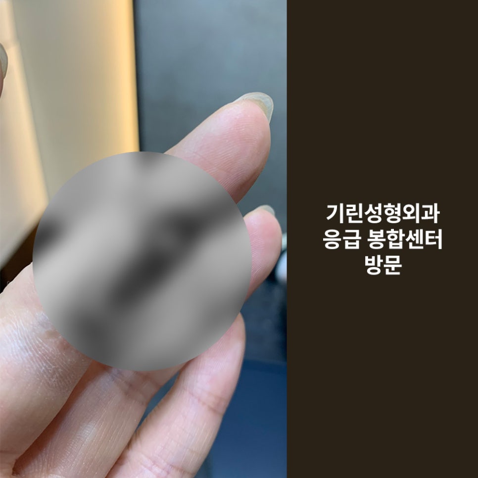 Girin Plastic Surgery for Finger Laceration Suturing, Skin Grafts, and Scar Care image 5
