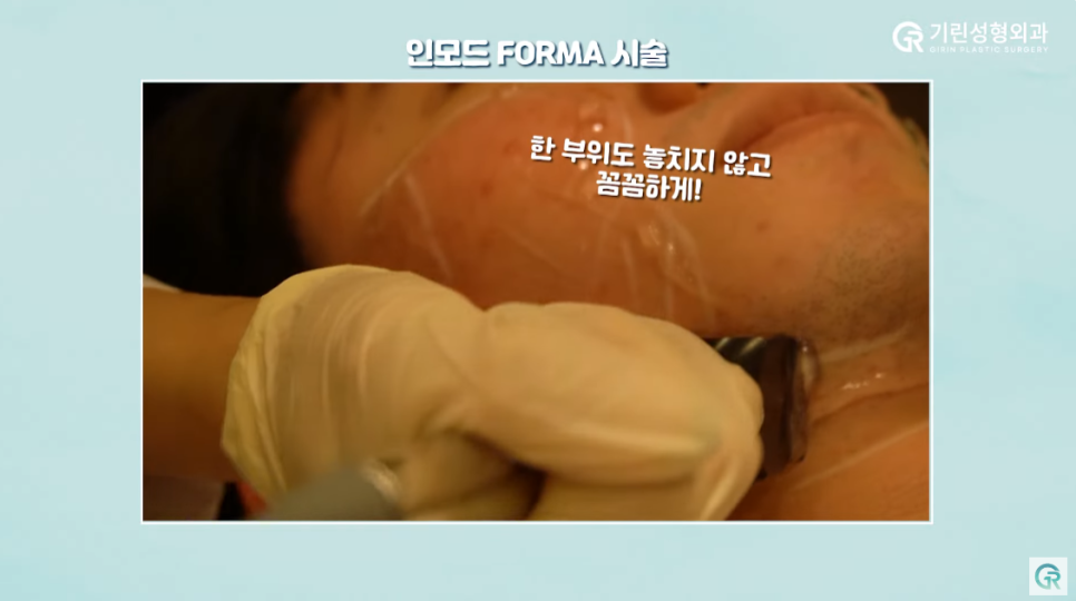 [기린성형외과의원] 수술 없이 턱라인 개선하기_인모드와 지방분해주사 관련 이미지 4