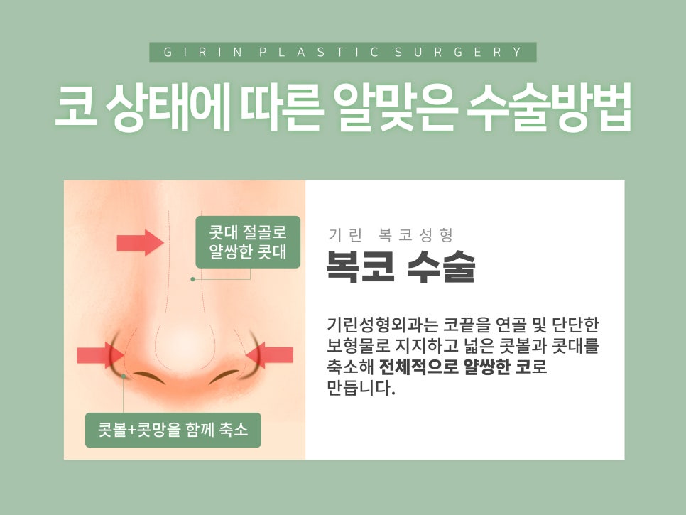 낮은코수술 원하는 라인으로 관련 이미지 8