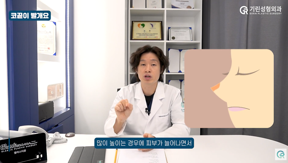 [기린성형외과] "딱 한 개비도 안될까요...?"_코성형 주의사항 Q&A 관련 이미지 4