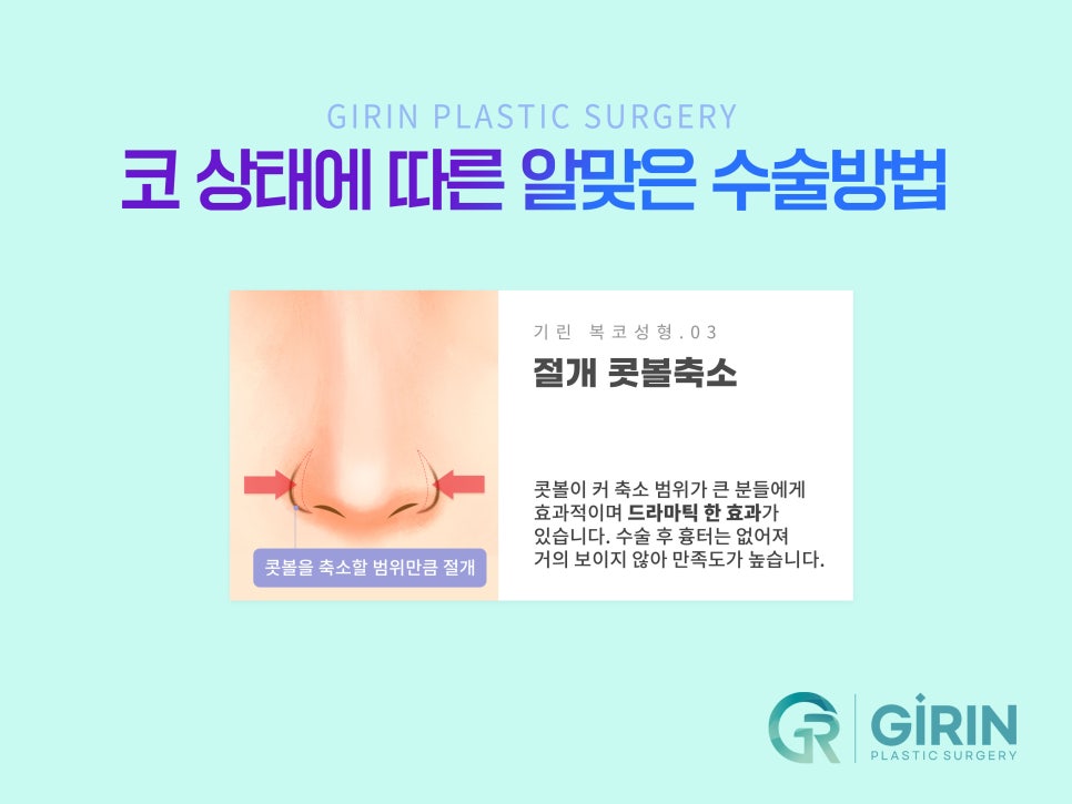 콧볼축소술 뭉툭한 코 개선을 위해 관련 이미지 7