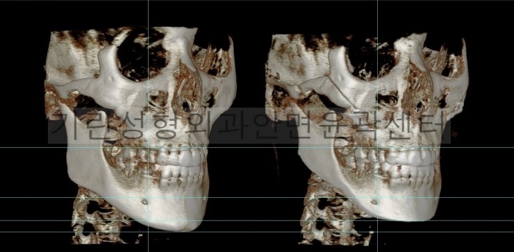 긴곡선을 통한 길이줄임 3주차 관련 이미지 4