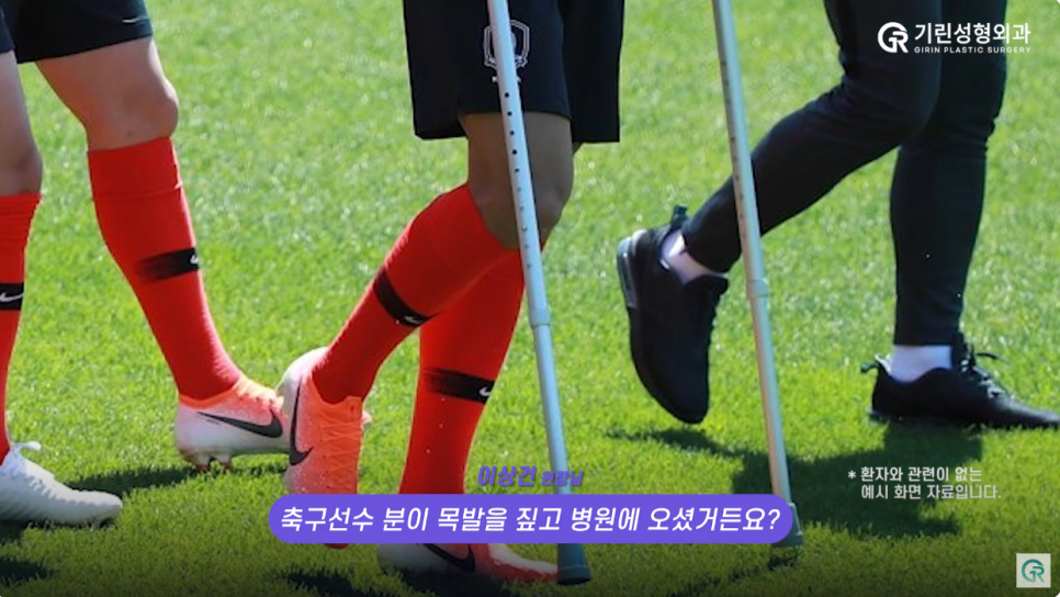 [기린성형외과의원] 코성형 후 격한 운동해도 될까?_코성형 주의사항 관련 이미지 8