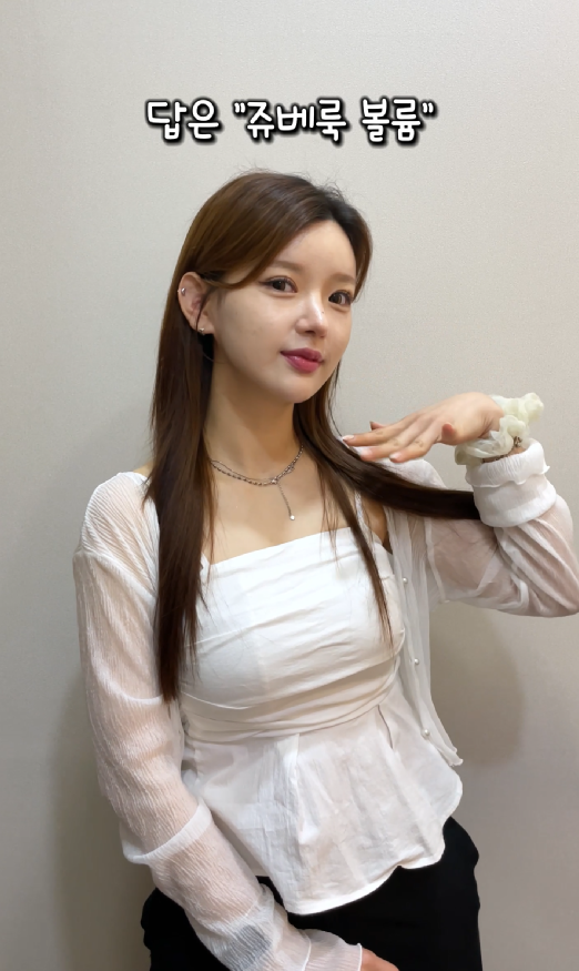 기린성형외과 쥬베룩볼륨 팔자주름, 앞볼, 관자 후기 관련 이미지 12