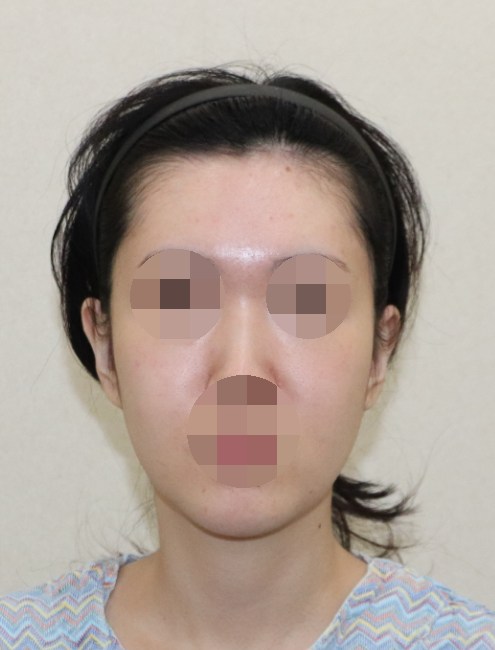 Features of Recently Preferred Facial Shapes, as Seen by a Soft-Tissue Contouring Specialist image 1