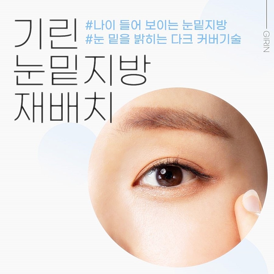 눈밑지방재배치 레이저 vs 수술후, 그동안 걱정했다면 관련 이미지 1