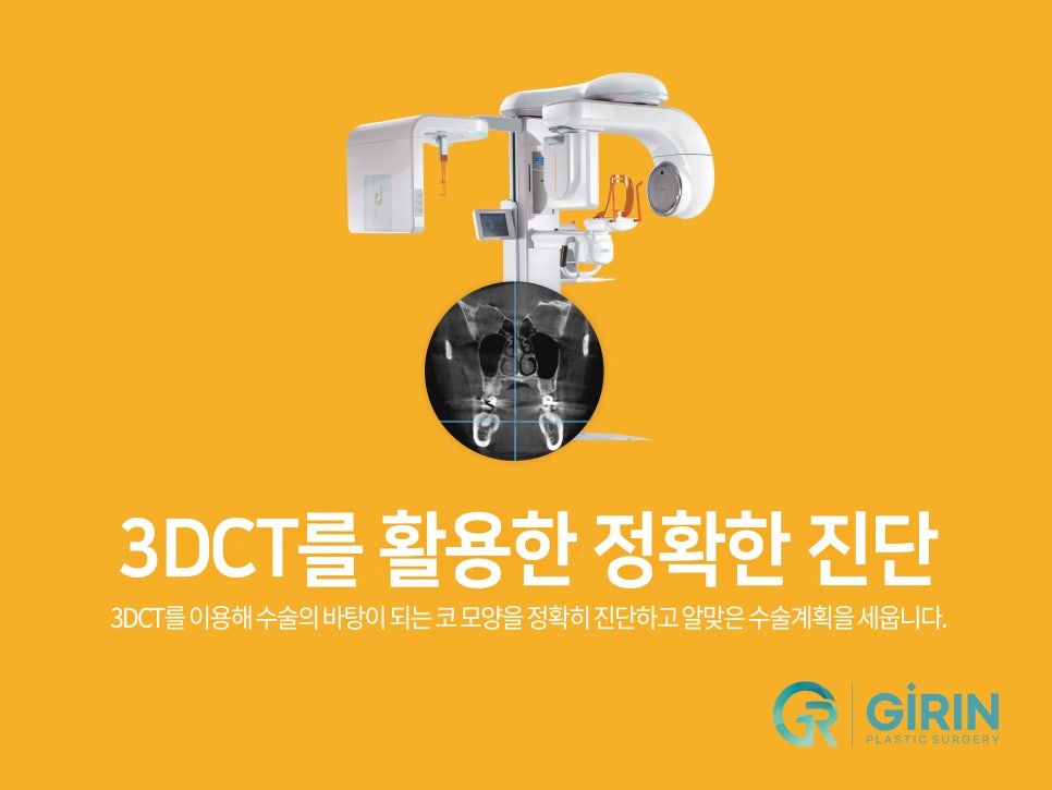 여자코성형후기 얼굴 비율까지 고려하여 관련 이미지 4
