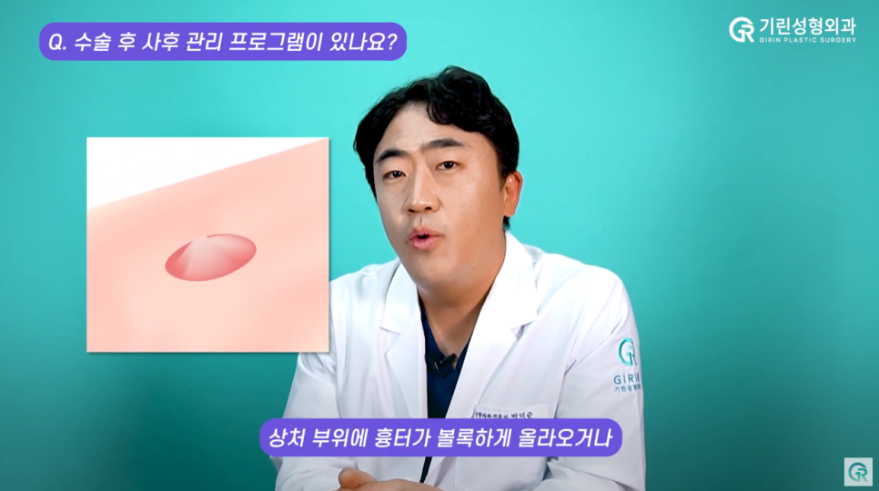 [기린성형외과] "흡연 얼마나 하세요?"_ 지방흡입수술 후 Q&A 관련 이미지 15