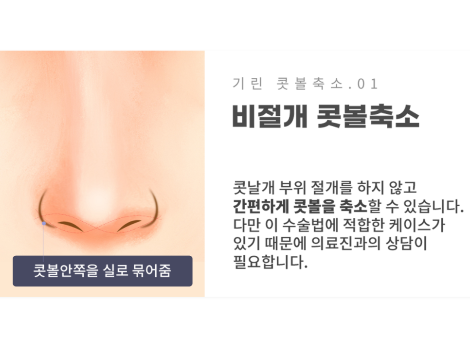 콧볼축소술 세련된 인상을 원한다면 관련 이미지 5