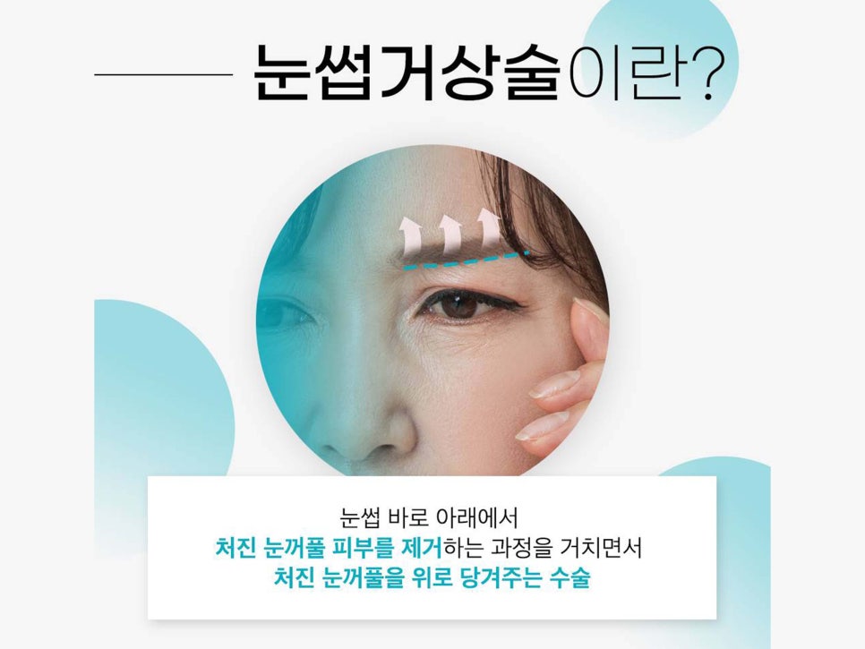 눈썹거상술후기 확인하고 싶다면 관련 이미지 4
