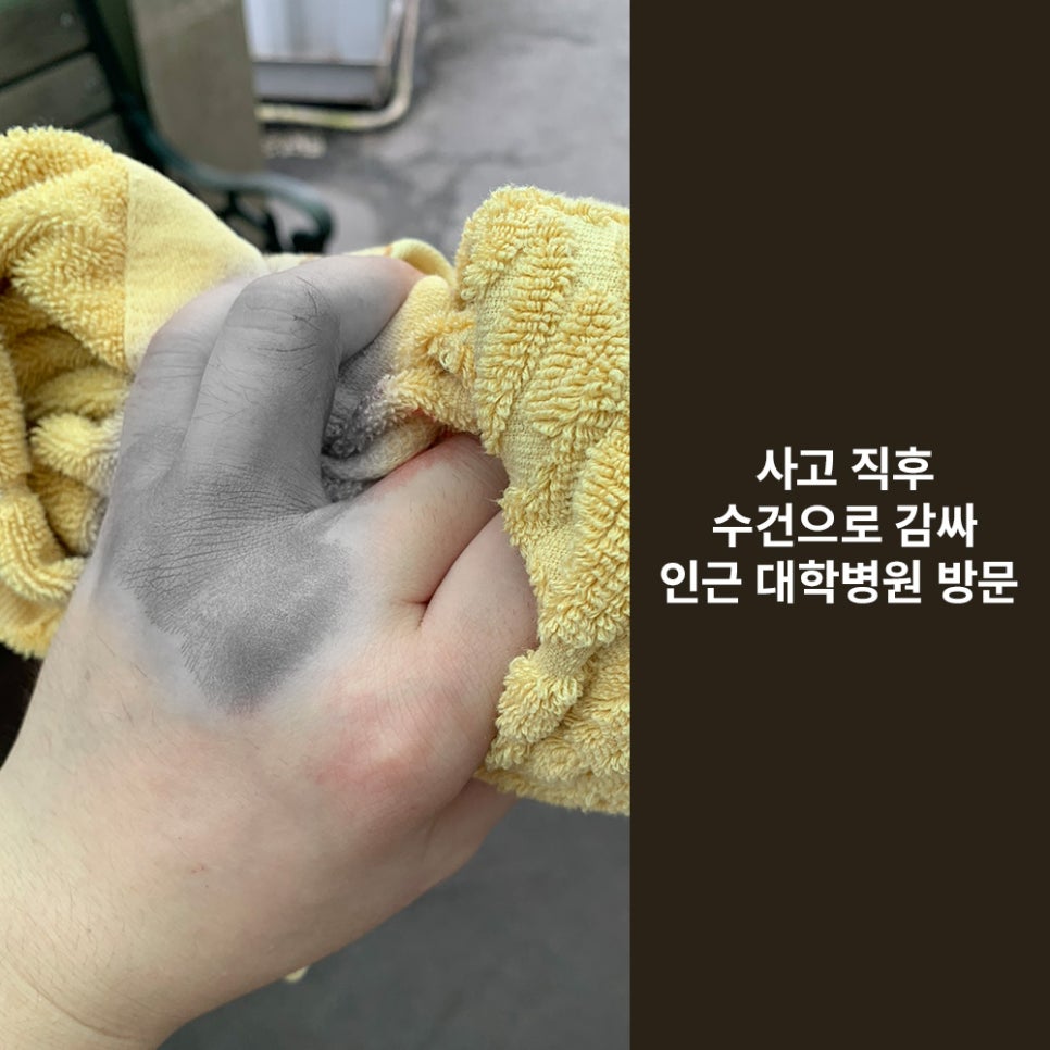 Girin Plastic Surgery for Finger Laceration Suturing, Skin Grafts, and Scar Care image 2