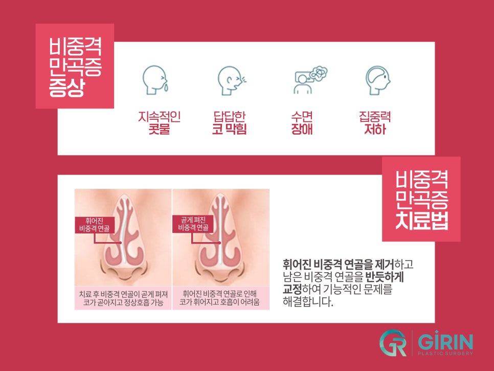 강남코성형 차이점이 있어야 관련 이미지 6