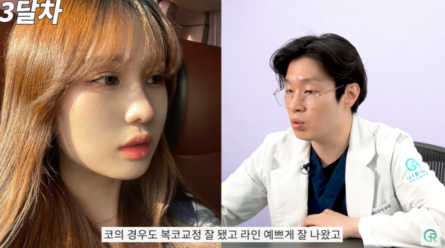 [기린성형외과] 작고 답답한 눈, 뭉뚝하고 낮은 복코 탈출!_눈성형, 코성형 수술일지 관련 이미지 11