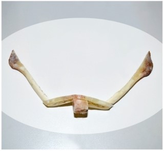 티절골만이 턱끝수술의 답일까? 관련 이미지 7