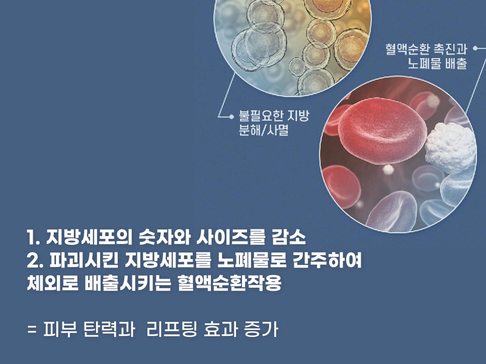 볼살윤곽주사 갸름한 라인 원한다면 관련 이미지 5