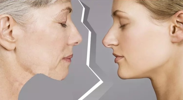 [공유] 안면거상술 고민중이시라면 꼭 읽어보세요! 다른 시술이 아닌 안면거상술을 선택해야 하는 해부학적 근거 관련 이미지 2