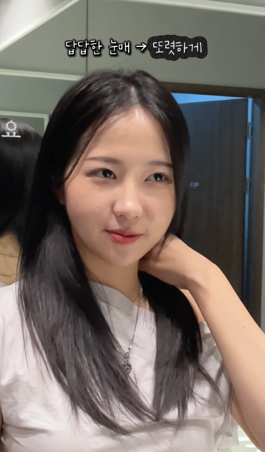 강남역 근처 쌍꺼풀 잘하는 곳 어디? 생생한 후기 관련 이미지 10