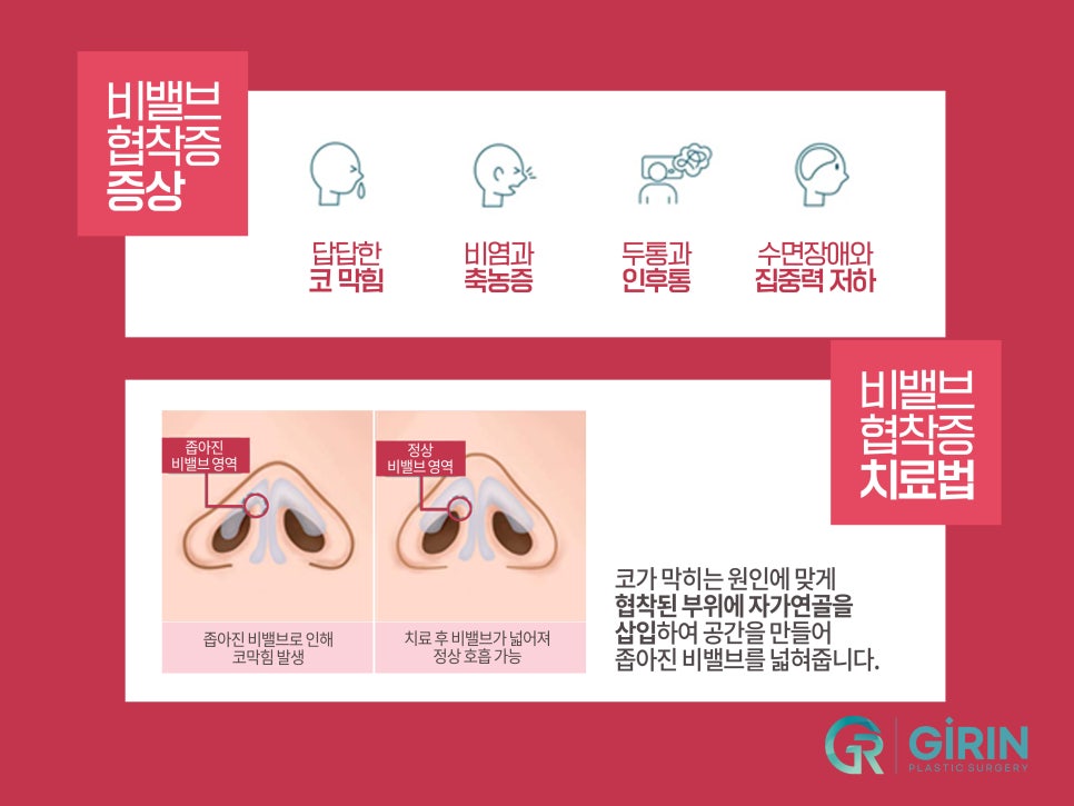 강남코성형 차이점이 있어야 관련 이미지 4