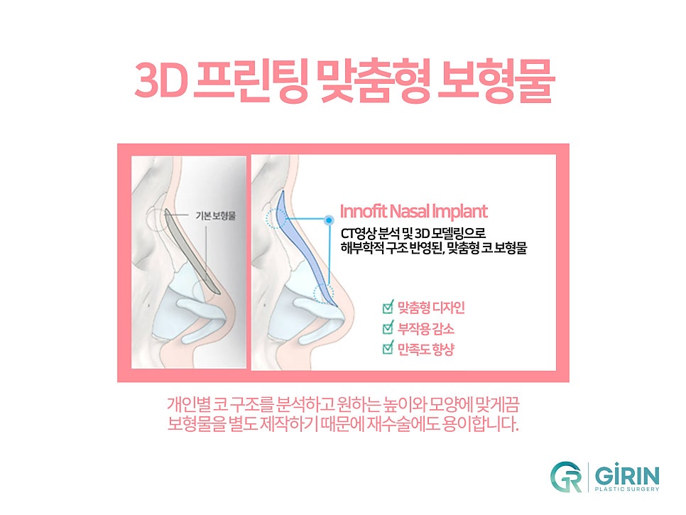 서울코재수술 마지막으로 살펴볼것 관련 이미지 10