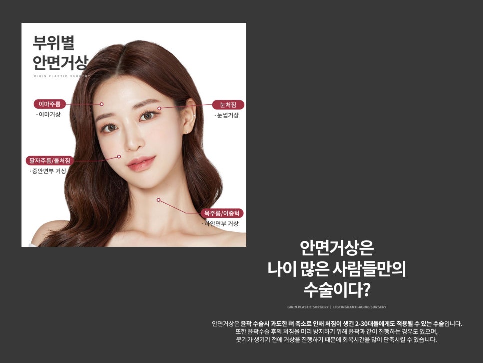 안면거상수술 효과 확실하려면 관련 이미지 8