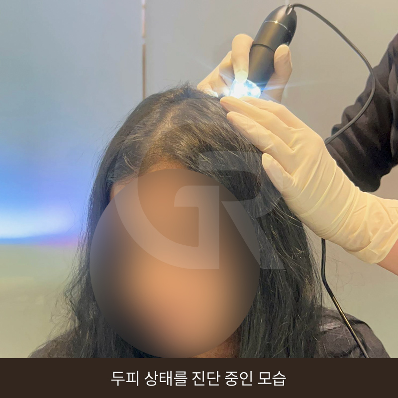 탈모 고민 두피 줄기세포 치료, 가격이 다른 이유는? 관련 이미지 6