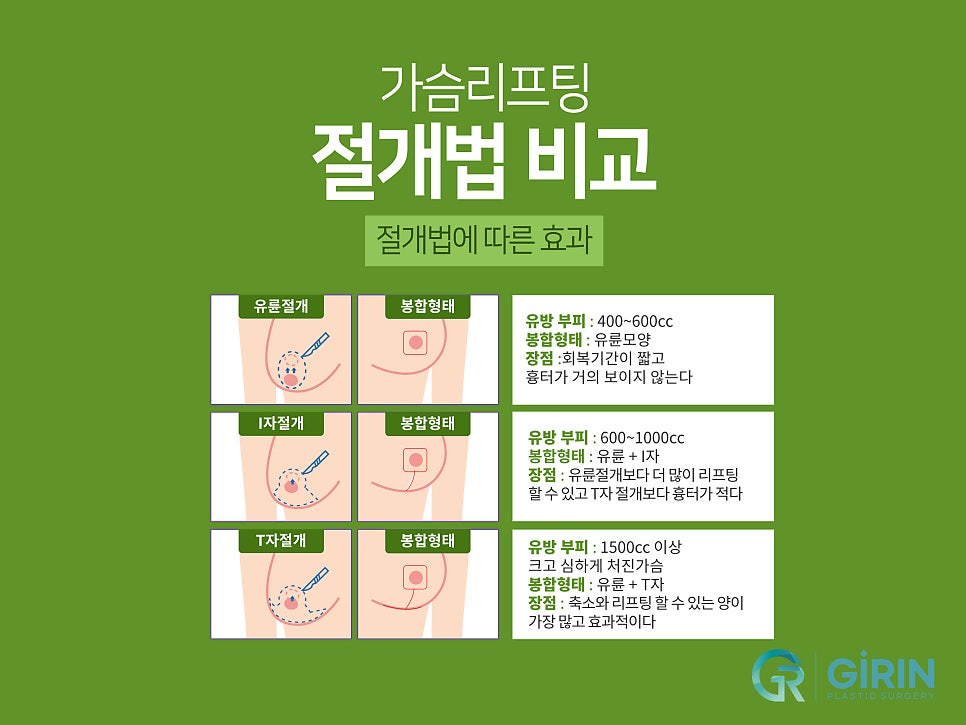 처진가슴수술후기 비교하며 선택한다면 관련 이미지 7